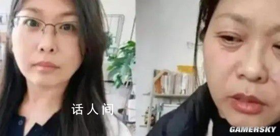 42岁断崖式衰老女子确诊卵巢早衰 脸部皱纹明显眼神憔悴